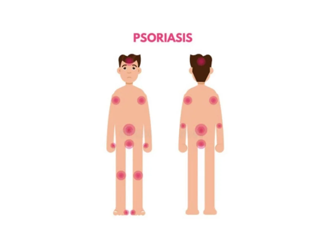 2d4416_024f009b25b940bb9208ef5062b60782mv2